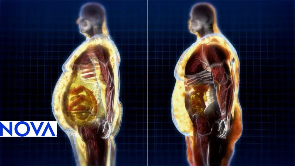 alcohol increases fat storage only if it puts you into a surplus. 