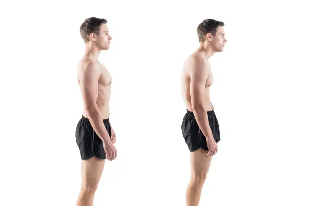 Good posture vs bad posture 